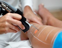 Tout savoir sur l'épilation au laser !