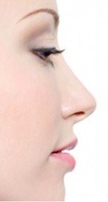 La rhinoplastie, la chirurgie esthétique ou réparatrice du nez expliquée par un chirurgien La rhinoplastie, la chirurgie esthétique ou réparatrice du nez expliquée par un chirurgien