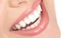 Comment avoir de belles dents blanches ?