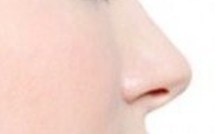 La rhinoplastie, la chirurgie esthétique ou réparatrice du nez expliquée par un chirurgien